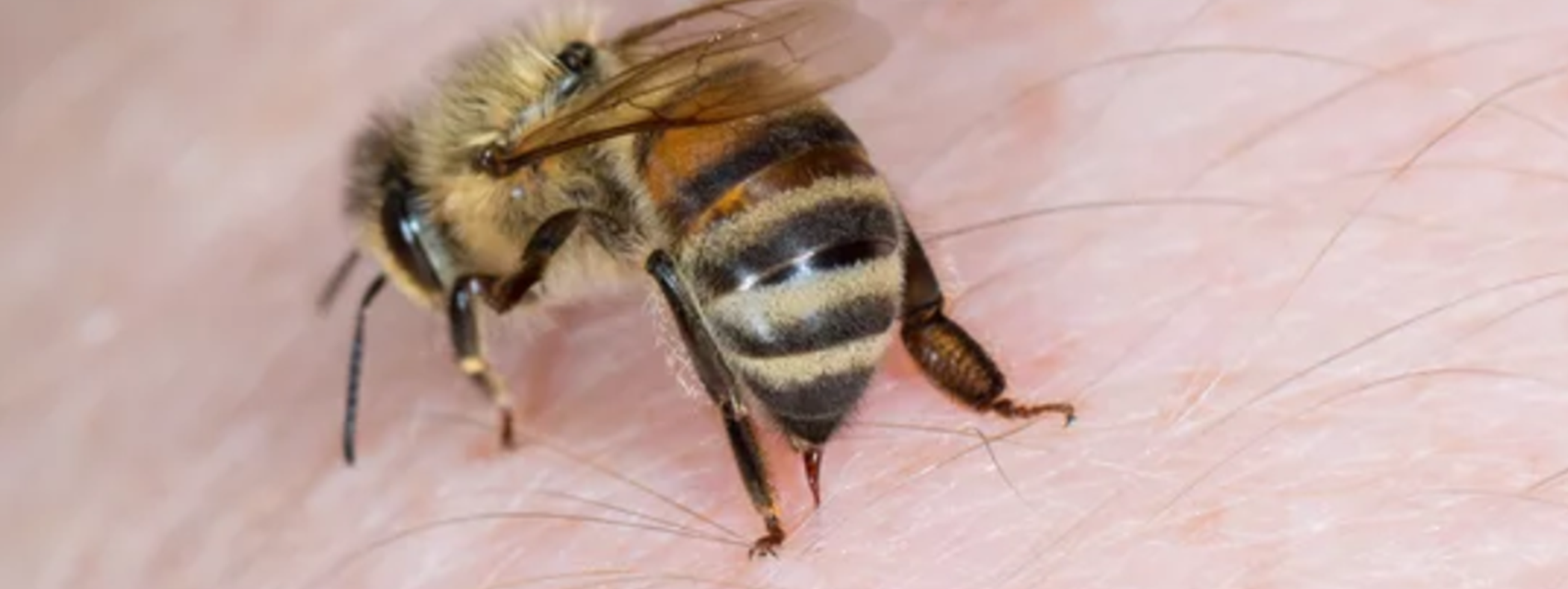 Burlington Pest Control: Why Do Bees Die After They Sting?