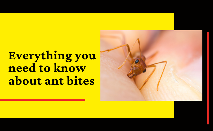 Everything you need to know about ant bites (1)