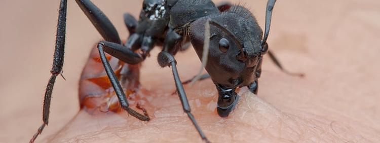 Ant Bites: Symptoms, Treatment, Prevention & Pictures