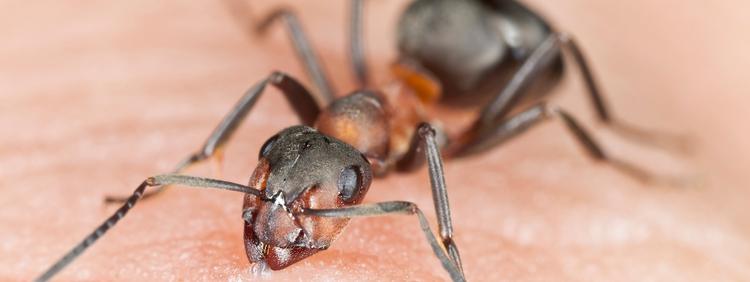 Kitchener Pest Removal Carpenter Ant Bites