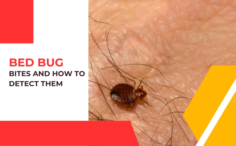 Niagara Pest Control_ Why We Dont Feel Bed Bug Bites and How to Detect Them
