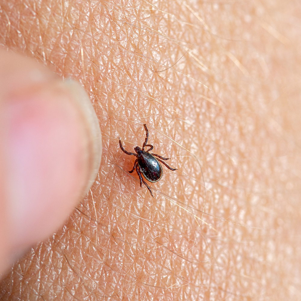 brown tick on human skin